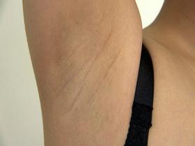 素人娘の全裸大図鑑11 5時間30人増刊号 今時の女の子が恥じらいながら脱衣していくヘアヌードコレクション +撮りおろし2人　サンプル画像10